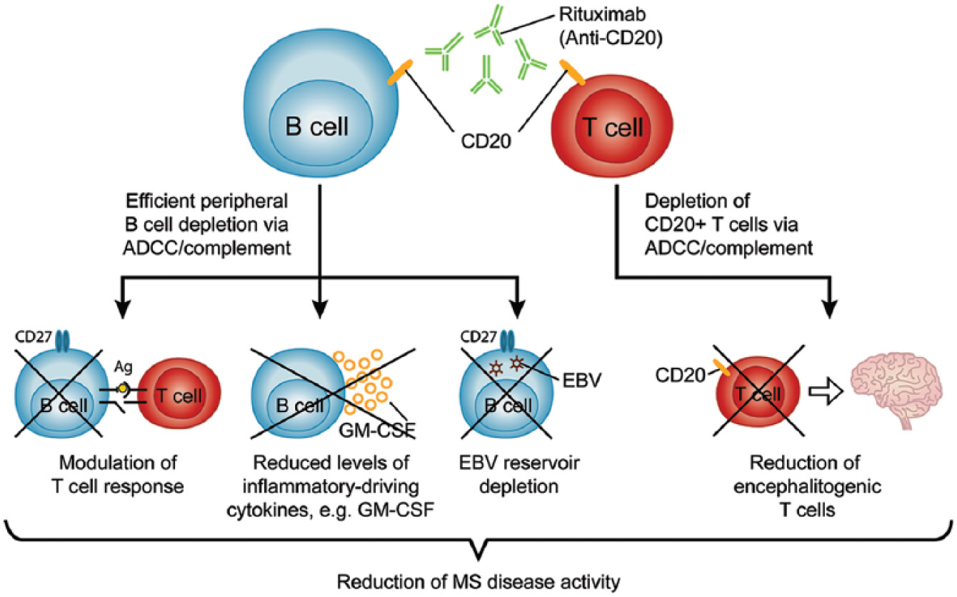 Rituximab treatment for multiple sclerosis.