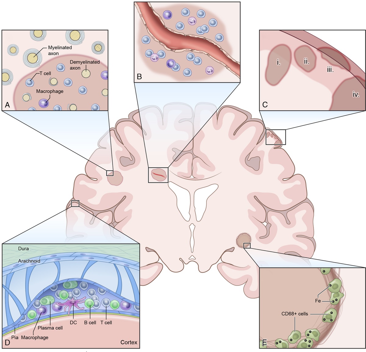 New Prospects for Ultra-High-Field Magnetic Resonance Imaging in Multiple Sclerosis